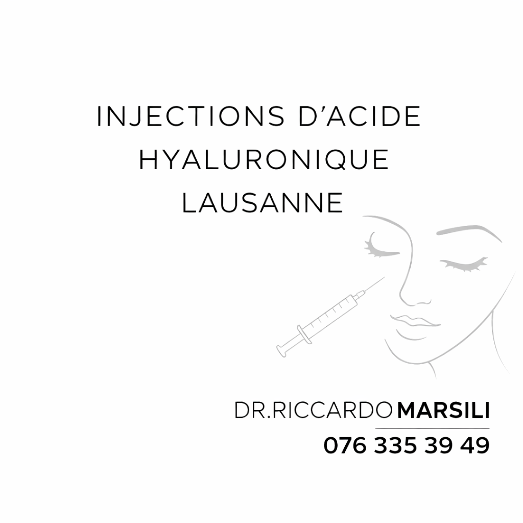 Injections acide hyaluronique Lausanne