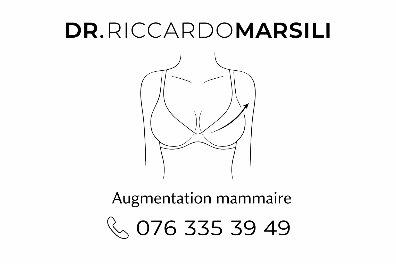 Augmentation mammaire Motiva à Lausanne : la référence en implants intelligents